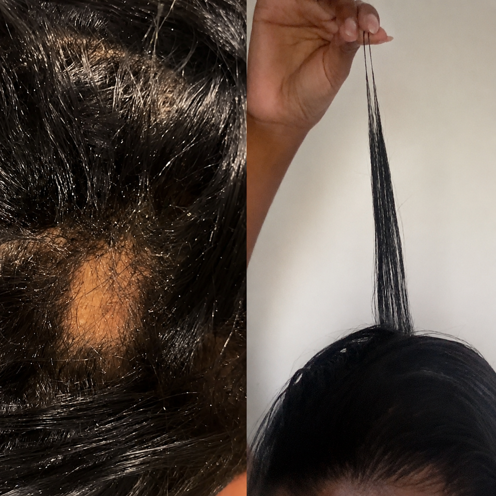 Kayla’s hair growth oil